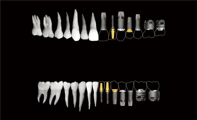 Photo of real teeth next to dental implant screws and abutements